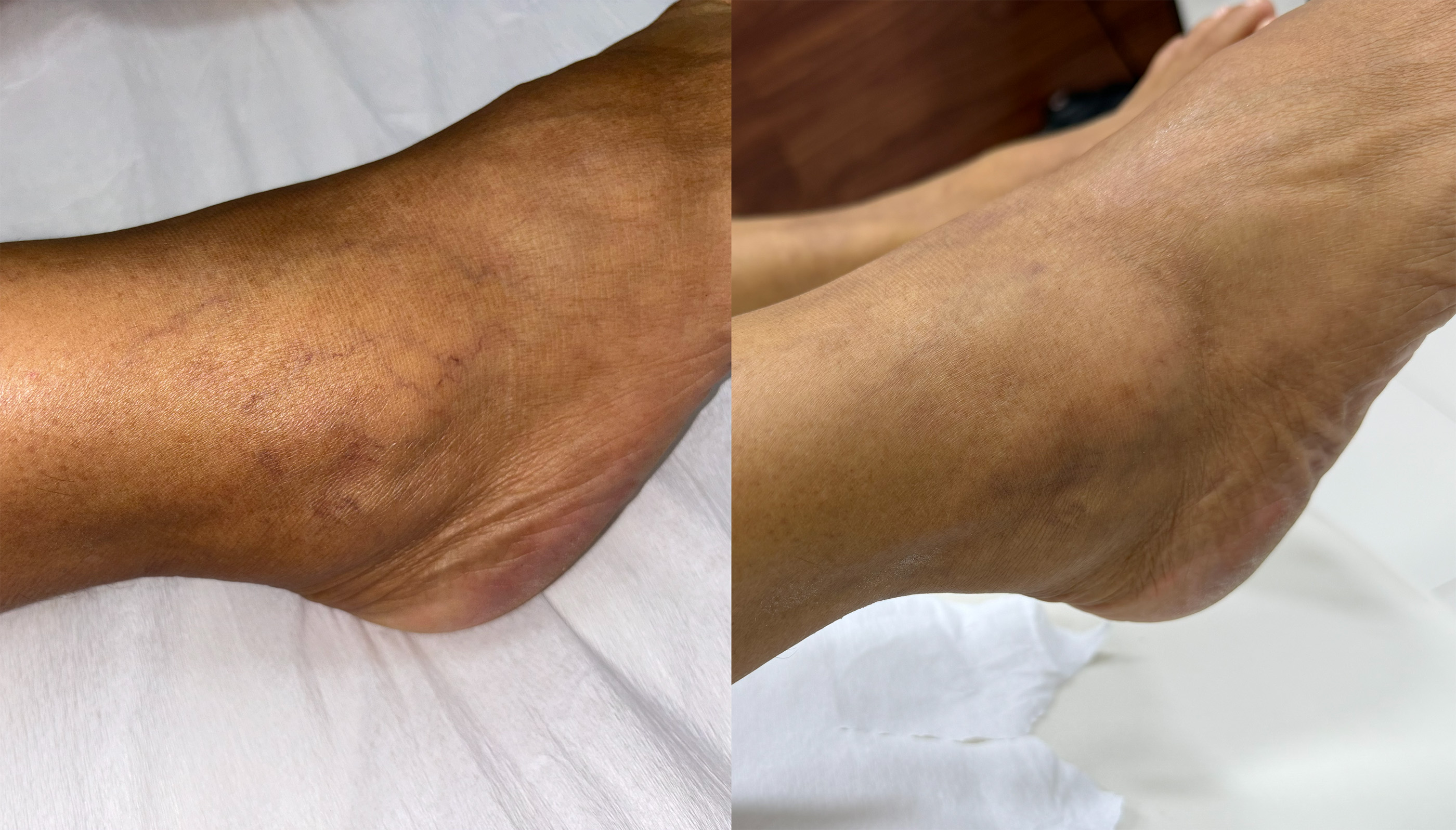 Caso 05 — Antes e Depois